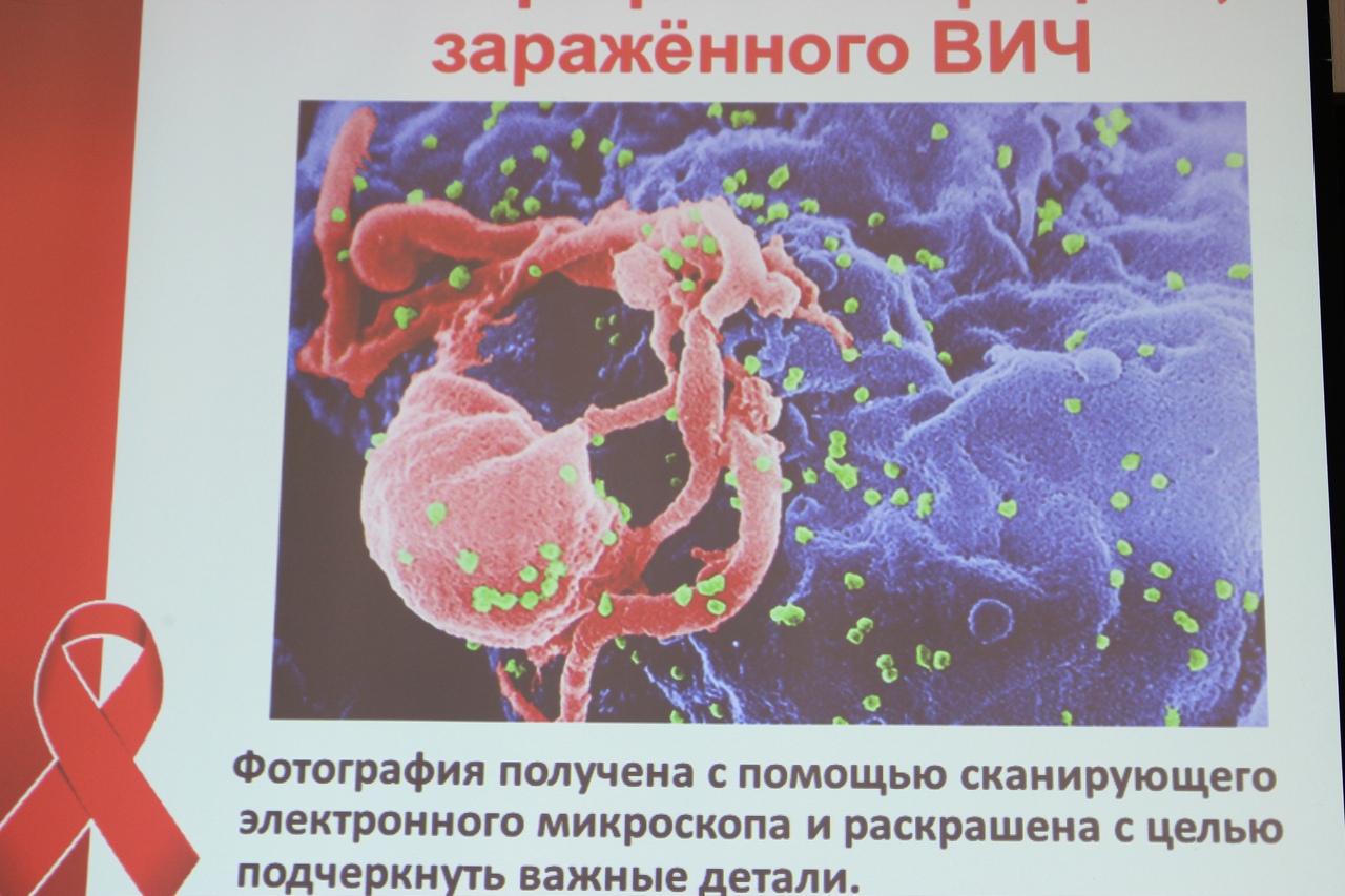 Заразилась вич в быту. ВИЧ микроскопическая фотография. Кровь ВИЧ инфицированного под микроскопом.